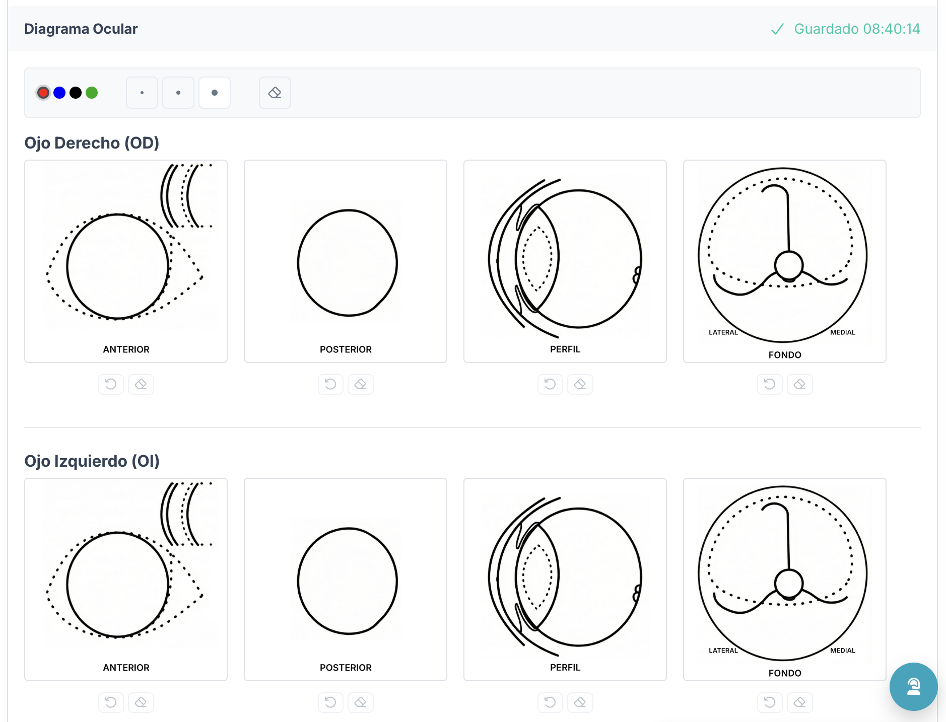 Diagrama ocular interactivo - OD y OI